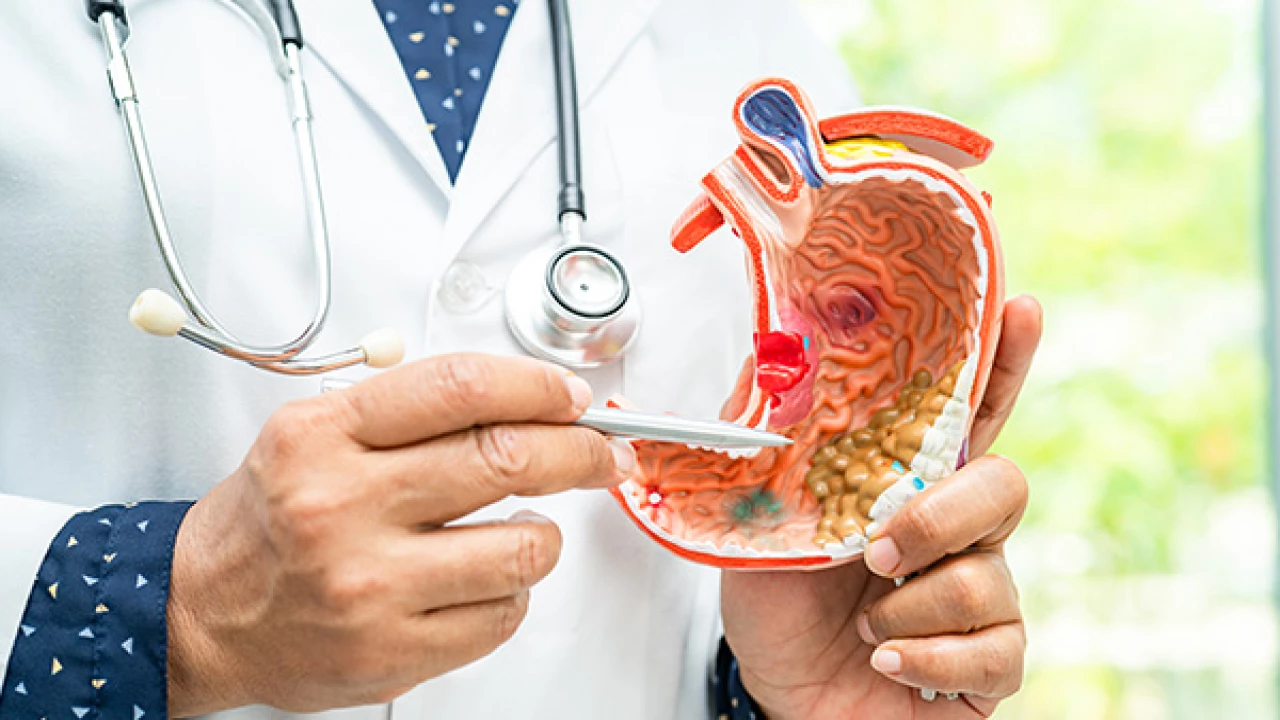 علاج القولون